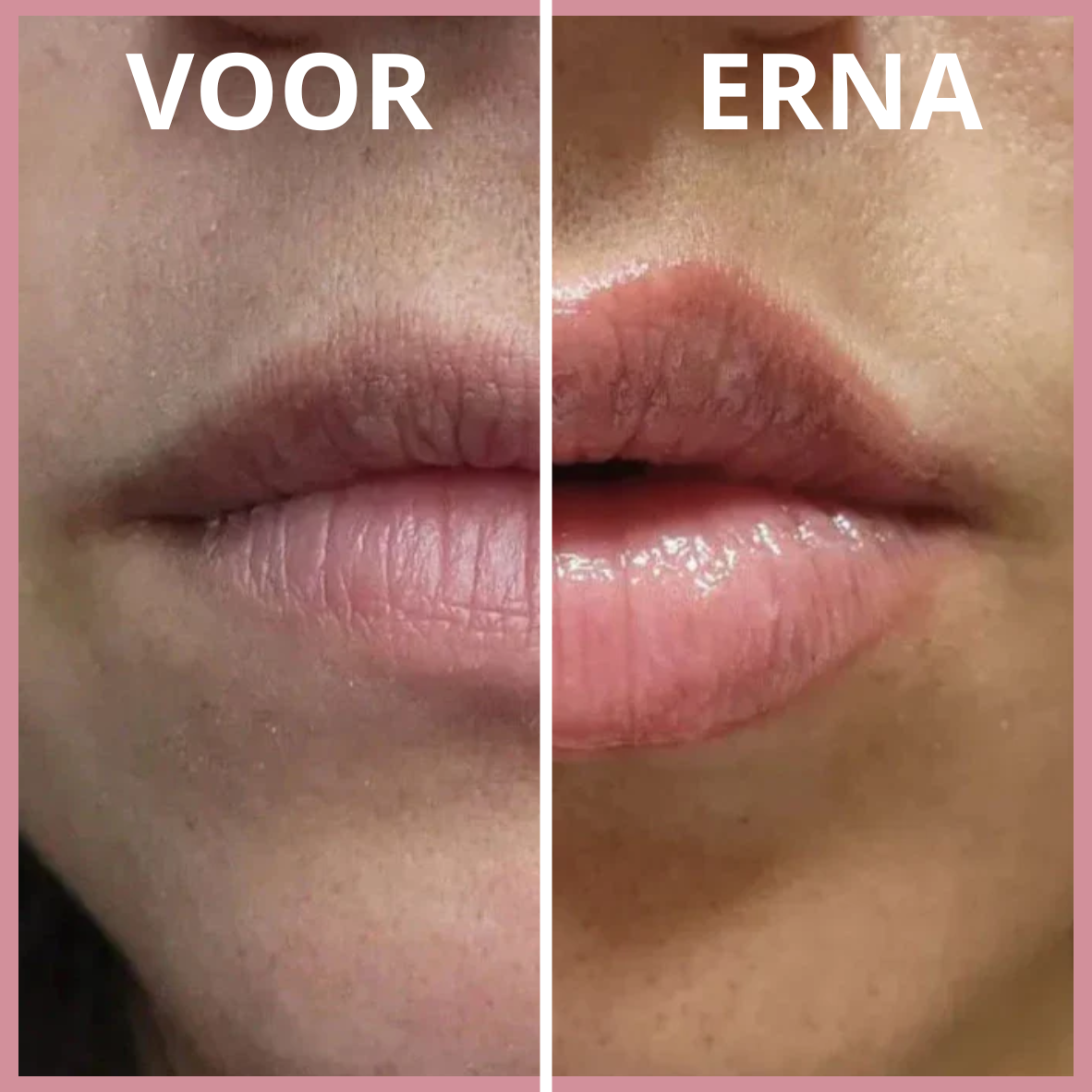Seno Lip Plumper